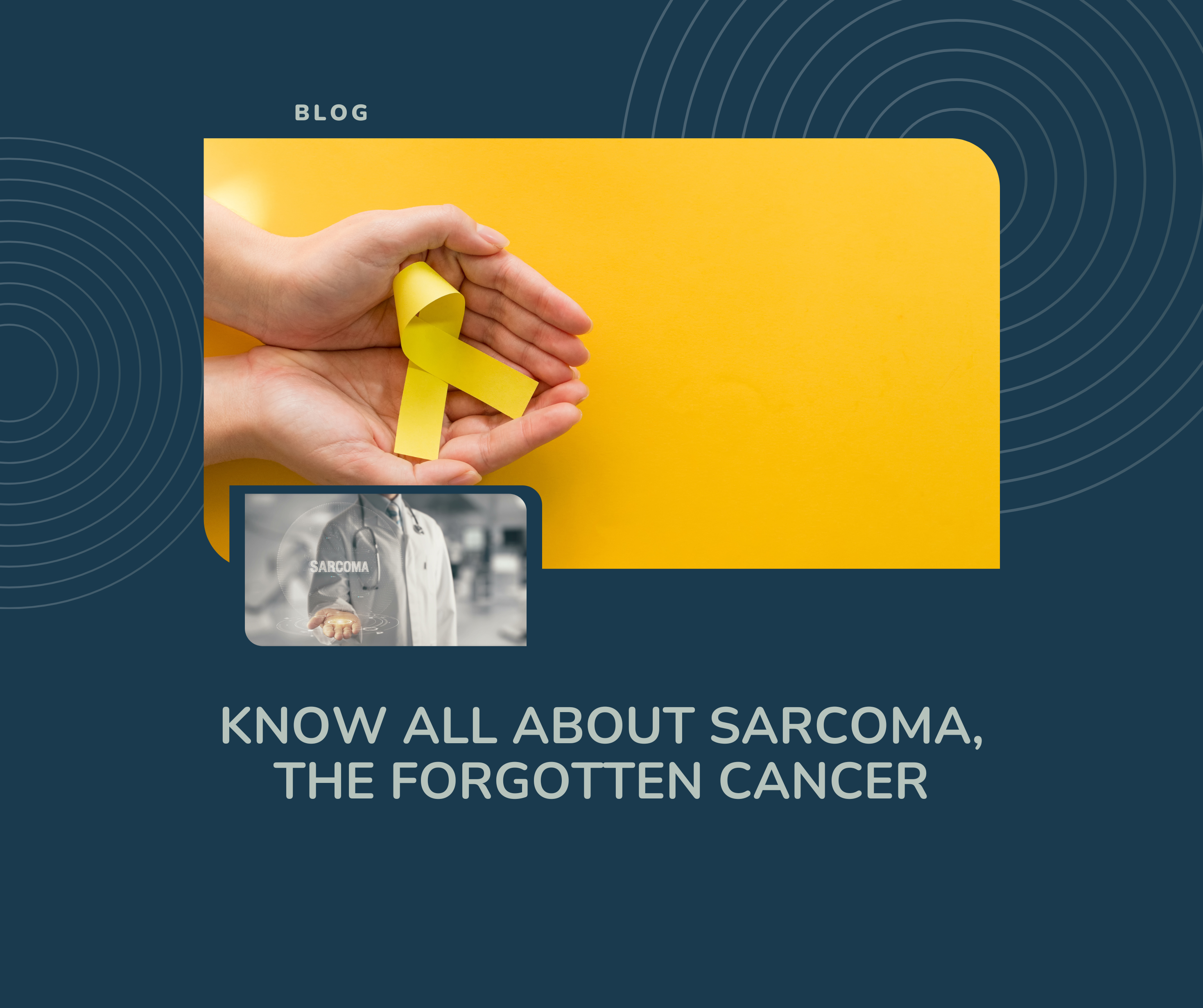 Know All About Sarcoma, the Forgotten Cancer
